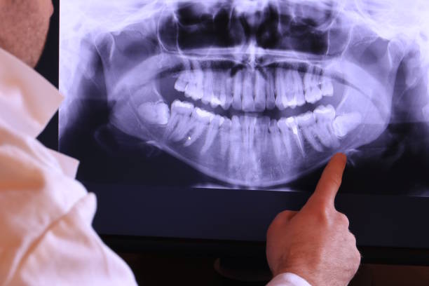 Best 24-Hour Emergency Dentist in Gervais, OR